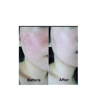 SNAIL REPAIR INTENSIVE AMPOULE 30ML