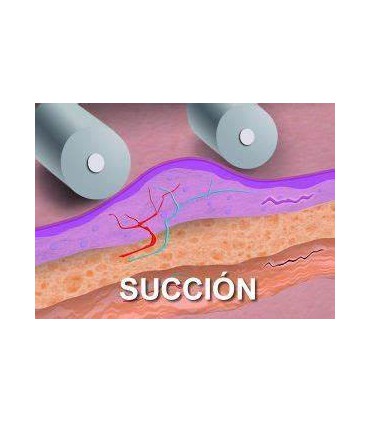 COMBI CORPORAL ROLLACTION + INDIBA BONO DE 10 SESIONES