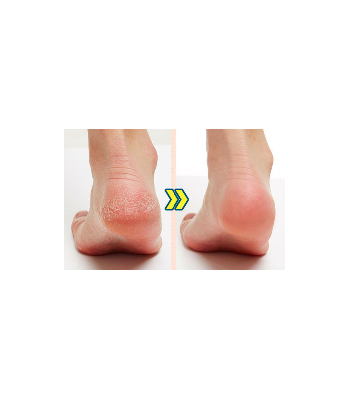APIEU SOFT FOOT PEELING SOCKS 