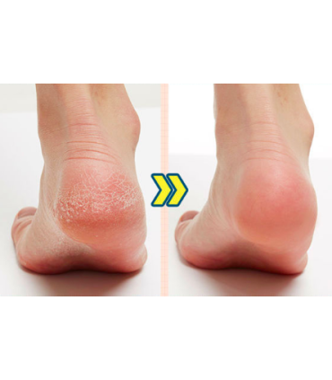 APIEU SOFT FOOT PEELING SOCKS 