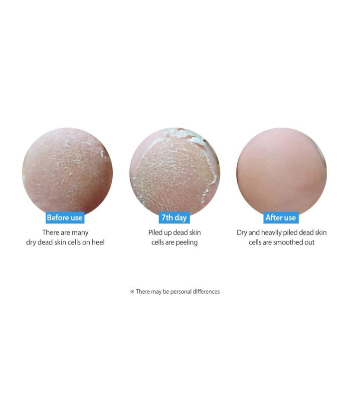 FRUDIA MY ORCHARD FOOT PEELING MASK (1 PAR)