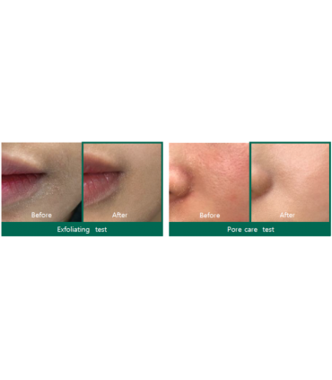 SOME BY MI AHA BHA PHA 30 DAYS MIRACLE TONER 150ML