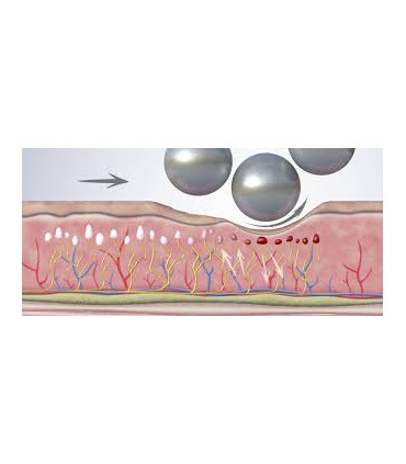 ESFERAS ROTATORIAS CORPORAL 10 SESIONES