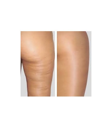 ESFERAS ROTATORIAS CORPORAL 10 SESIONES