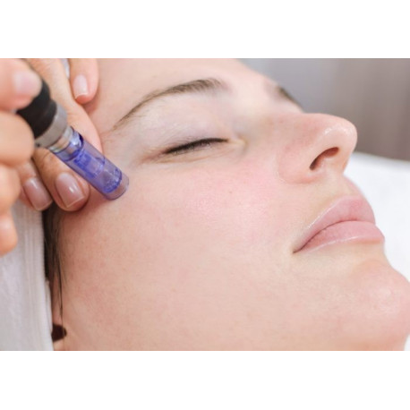 DERMAPEN FACIAL BONO 3 SESIONES