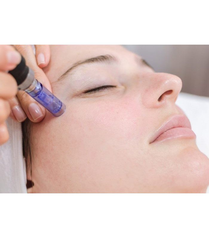 DERMAPEN FACIAL BONO 3 SESIONES