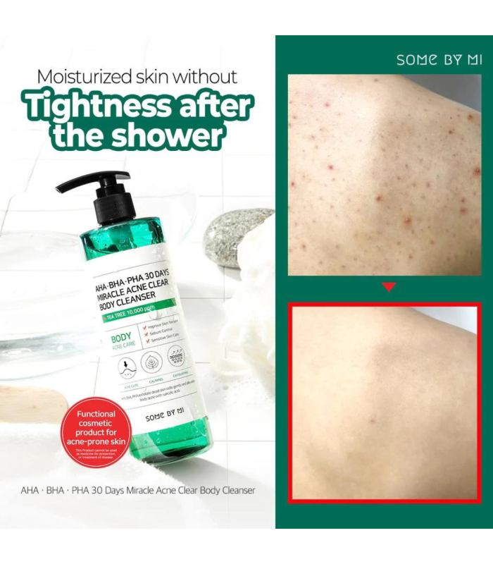 SOME BY MI AHA BHA PHA 30 DAYS MIRACLE ACNE CLEAR BODY CLEANSER 400G