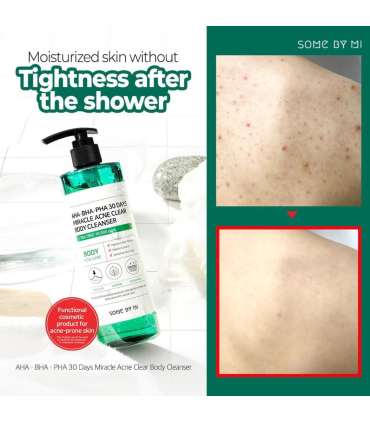 SOME BY MI AHA BHA PHA 30 DAYS MIRACLE ACNE CLEAR BODY CLEANSER 400G