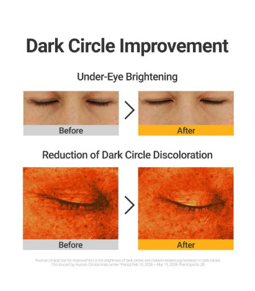 Rovectin Dark Circle Roller | Sérum Iluminador para Ojeras